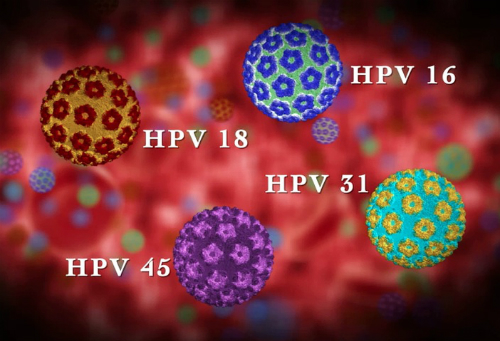 95% các trường hợp ung thư cổ tử cung phát hiện thấy virus HPV. Ảnh minh họa: doctor