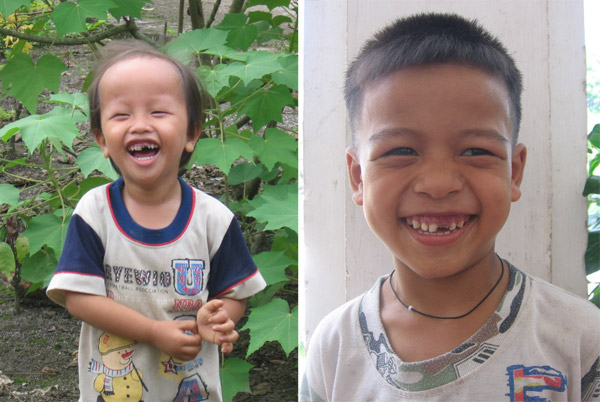 Hai cậu bé trong trại phong Ba Sao vẫn cười vui vẻ rạng rỡ dù cuộc sống không mỉm cười với em.