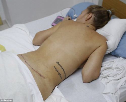 Venezuela: Sự thật ghê sợ đằng sau nhan sắc | Làm đẹp, Phẫu thuật thẩm mỹ, Venezuela, Bơm môi, Độn mông, Nâng ngực, Sẹo, Dao kéo