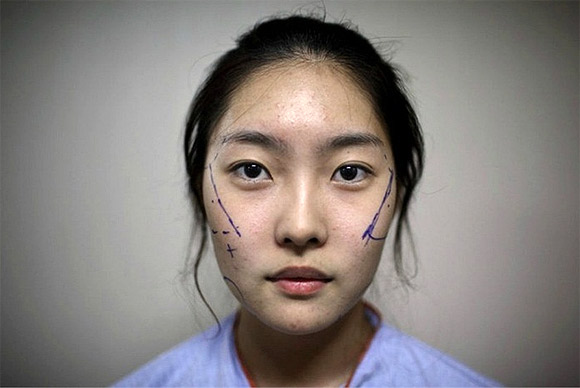  Nỗi đau đớn của thiếu nữ Hàn Quốc khi phẫu thuật thẩm mỹ 1