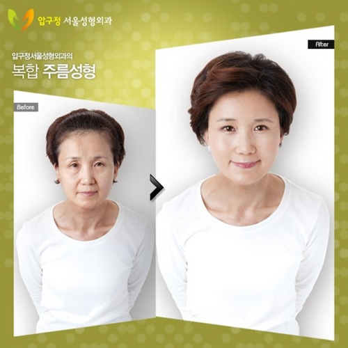 Sự kỳ diệu của phẫu thuật thẩm mỹ xứ Hàn 9