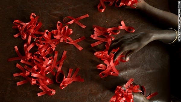 Thêm 2 bệnh nhân nhiễm HIV được chữa khỏi 1